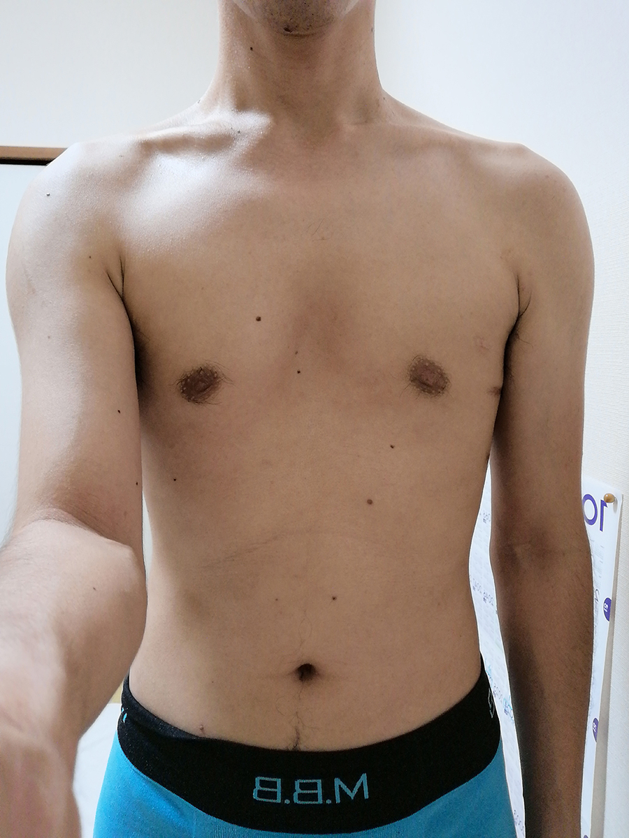 2019年9月6日時点の身体の写真（正面）