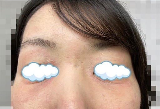 f:id:shakkun321:20230317080939j:image