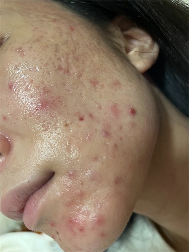 f:id:shakkun321:20240319233838j:image