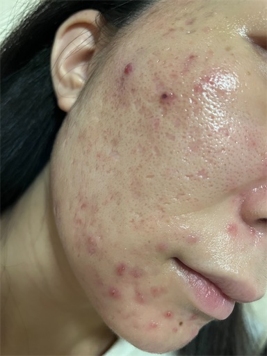 f:id:shakkun321:20240319233841j:image