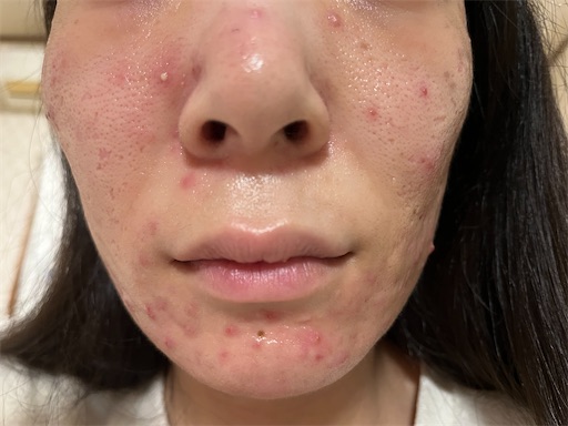 f:id:shakkun321:20240319233847j:image