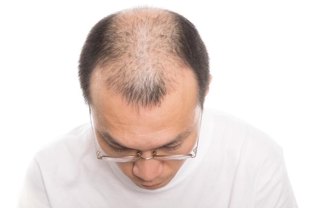f:id:shangrila686:20181114233105j:plain f:id:shangrila686:20181114233105j:plain