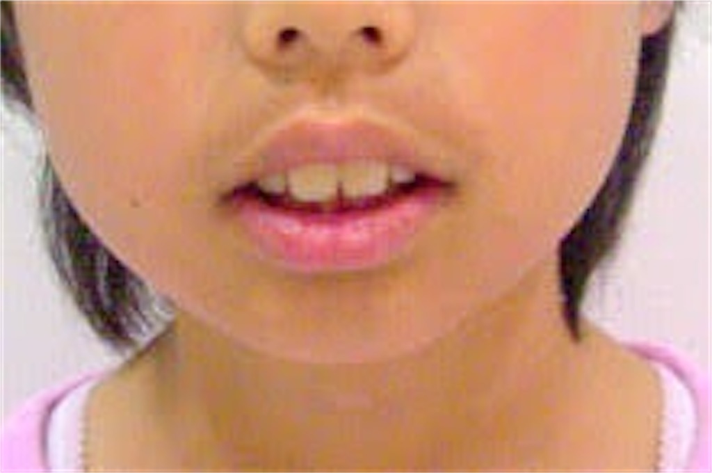 f:id:shiawasehanarabimake:20210929120527j:image