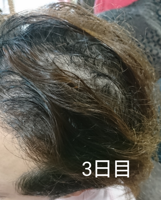 f:id:shibalog:20180914124109p:plain