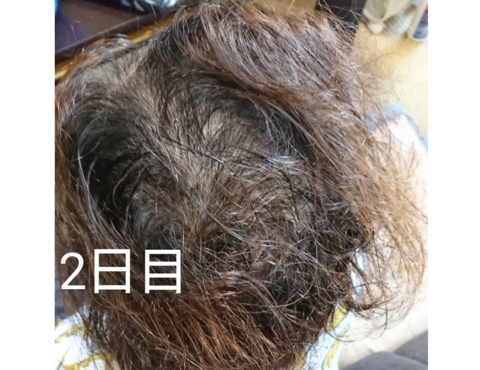 f:id:shibalog:20180914124116p:plain