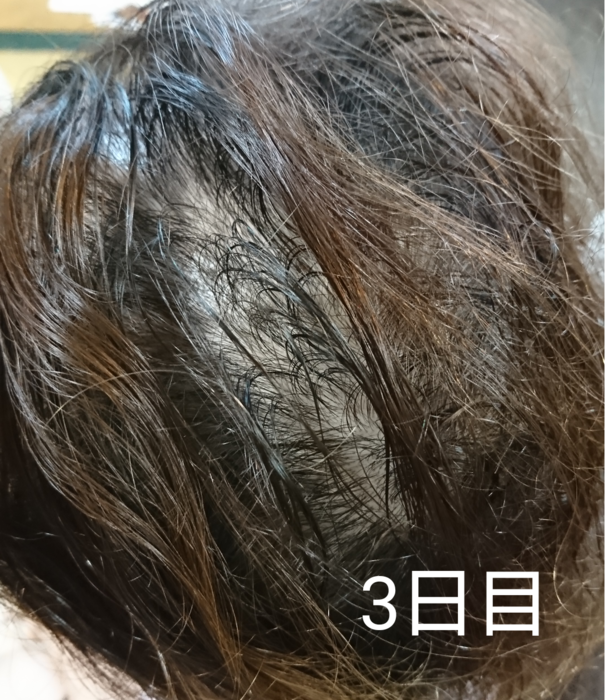 f:id:shibalog:20180914125142p:plain