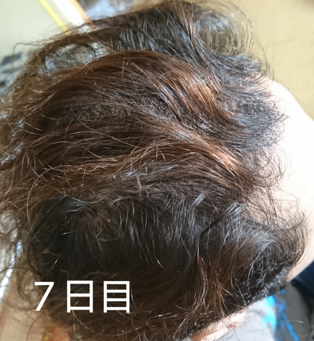 f:id:shibalog:20180914131645p:plain