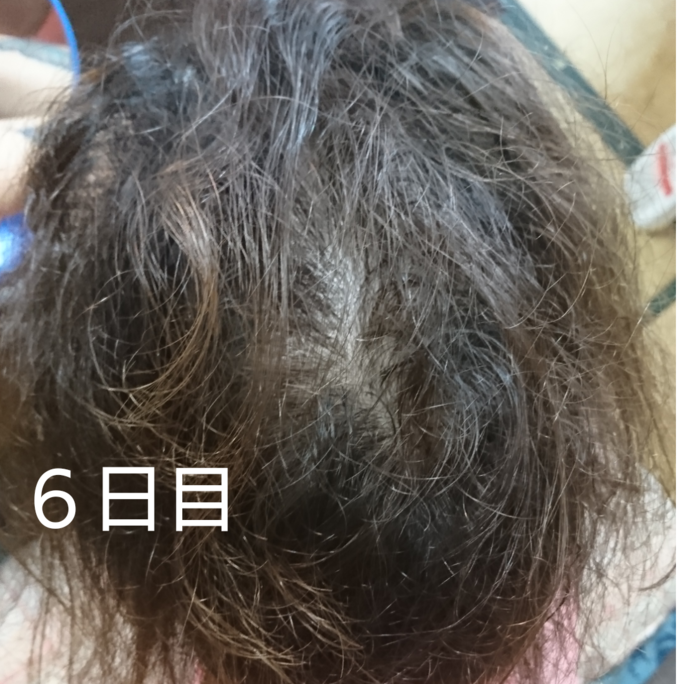 f:id:shibalog:20180914131708p:plain