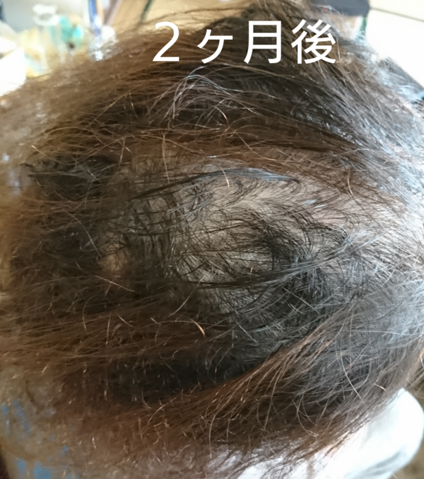 f:id:shibalog:20181128160815p:plain