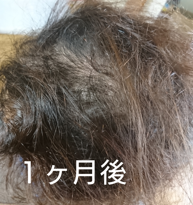 f:id:shibalog:20181128161023p:plain