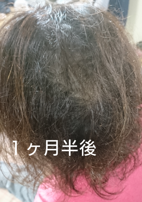 f:id:shibalog:20181128161041p:plain