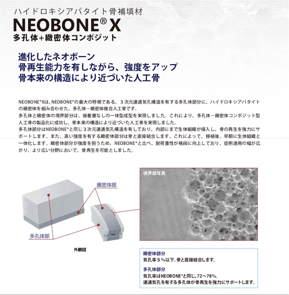 f:id:shigechikun:20190724074030j:image