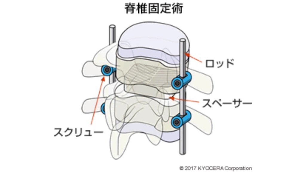 f:id:shigechikun:20190724074105j:image