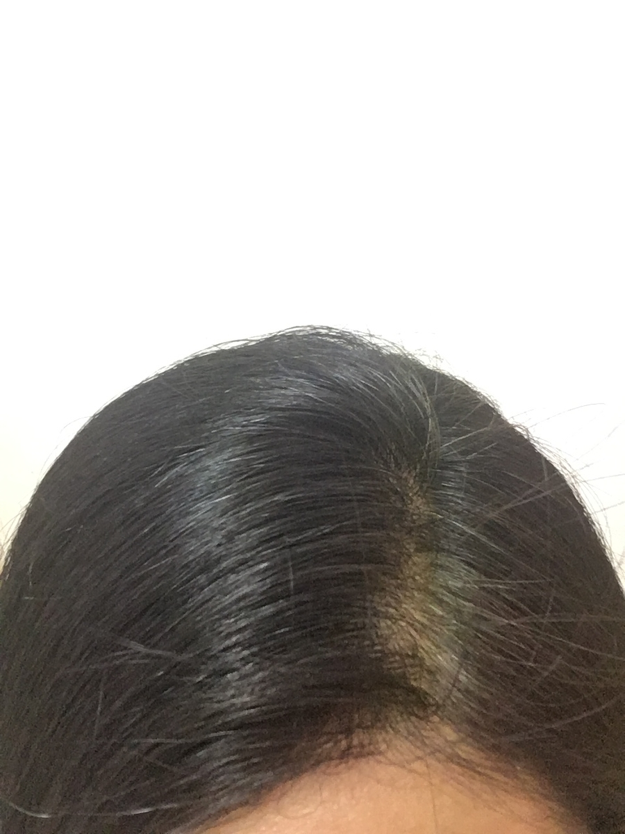 f:id:shikekox:20200216210207j:plain f:id:shikekox:20200216210207j:plain