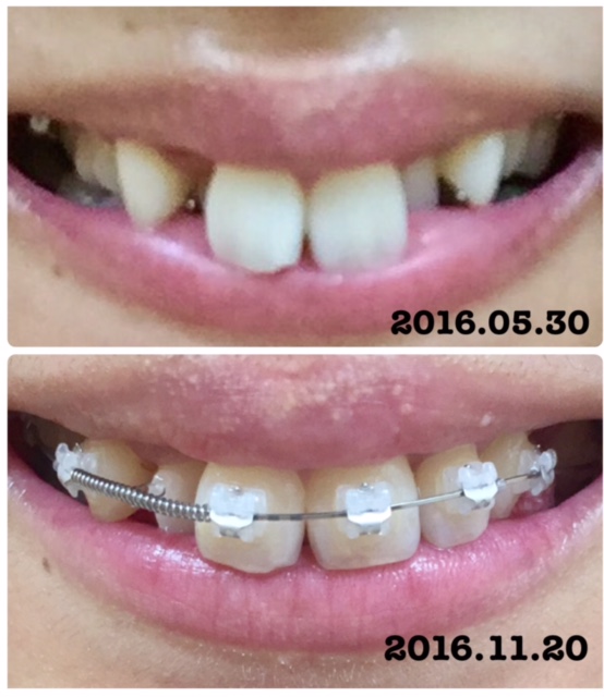 f:id:shiorintantan:20161121141813j:plain f:id:shiorintantan:20161121141813j:plain
