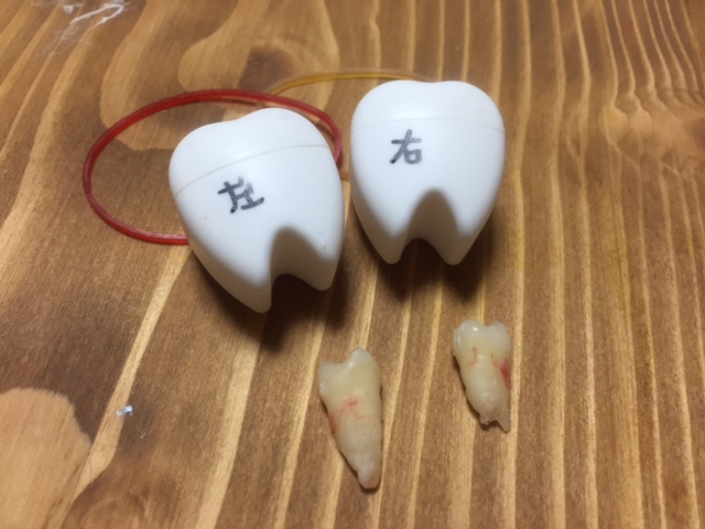 f:id:shiorintantan:20161121141821j:plain f:id:shiorintantan:20161121141821j:plain