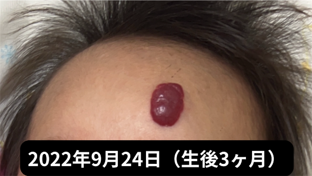 f:id:shipposhimashima_neko:20230121042819p:image