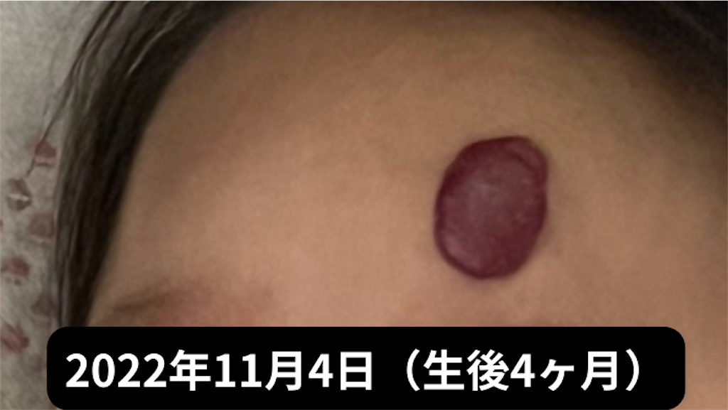 f:id:shipposhimashima_neko:20230121042833p:image