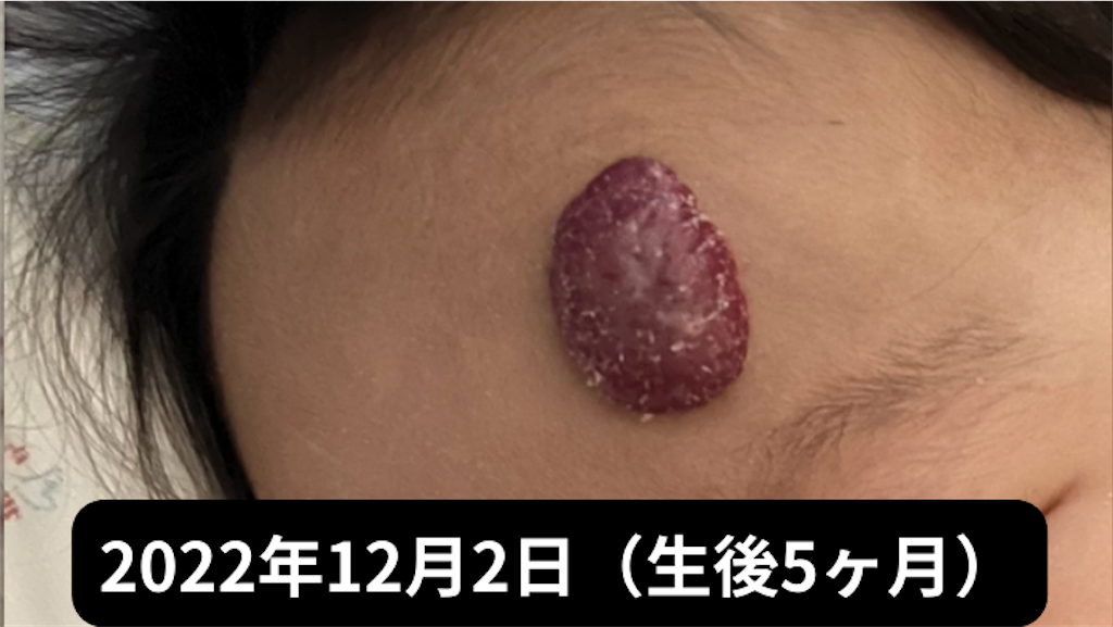 f:id:shipposhimashima_neko:20230121042839p:image