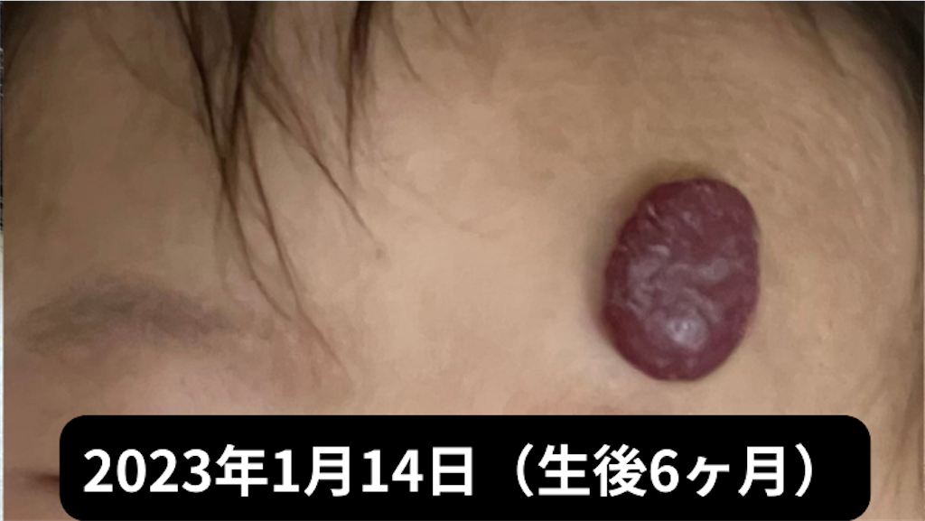 f:id:shipposhimashima_neko:20230121042846p:image