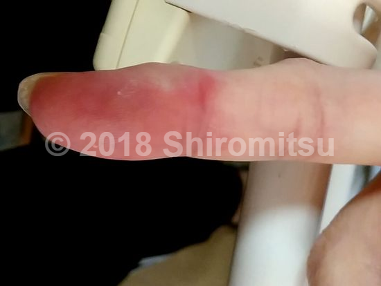 f:id:shiramitsu:20180414020951p:plain f:id:shiramitsu:20180414020951p:plain