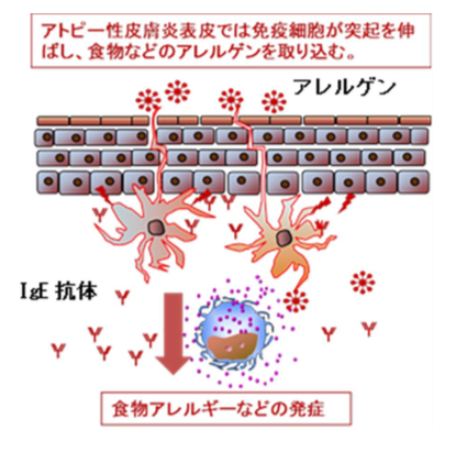 赤ちゃんにオーガニックケアは危険 肌を見て適切な保湿ケアを アレルギー 今日のおやつはなんだろな