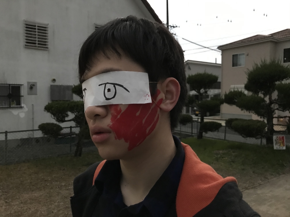 ビンタって、くらうと頬に手形ってつくの?? - 落花生ラッコの楽しい生活