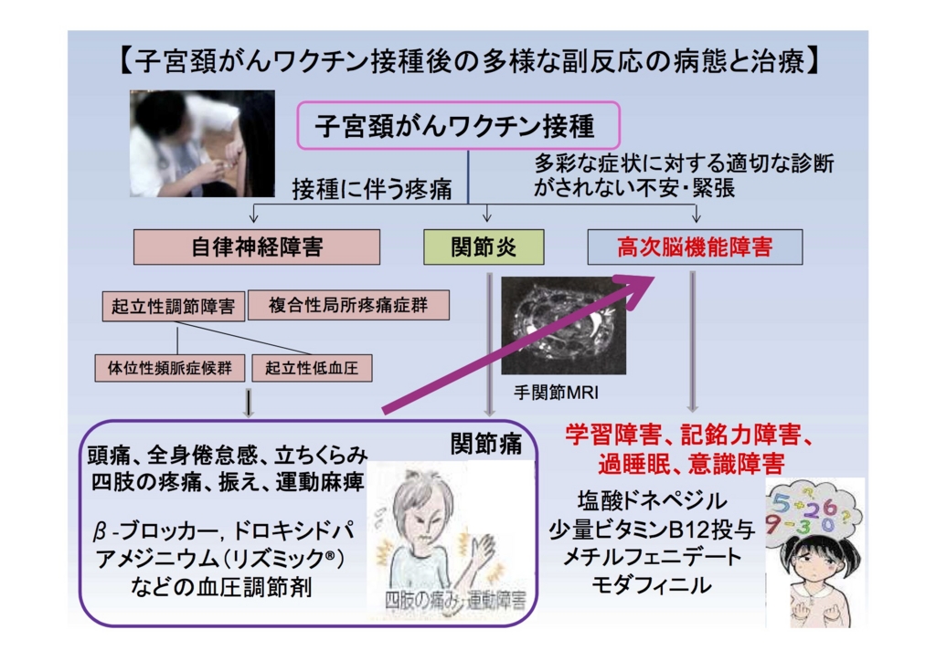 f:id:simbelmyn:20160318152843j:plain f:id:simbelmyn:20160318152843j:plain