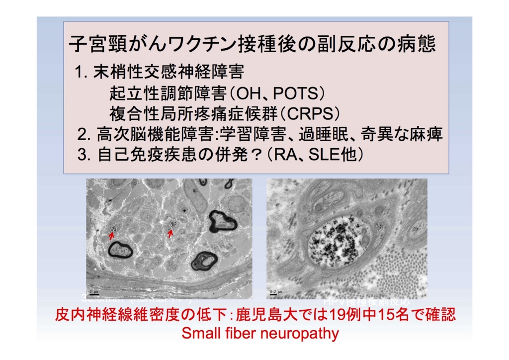f:id:simbelmyn:20160318153014j:plain f:id:simbelmyn:20160318153014j:plain