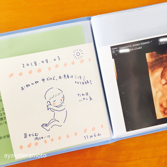 母子手帳ケースの中身を整理 エコー写真を収納するファイル Dvdも収納します 心を楽に シンプルライフ