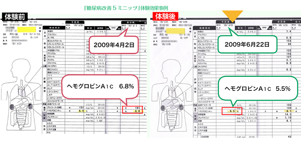 自宅でラクにできる「青坂式」糖尿病改善プログラム 自宅でラクにできる「青坂式」糖尿病改善プログラム 1日5分 足裏