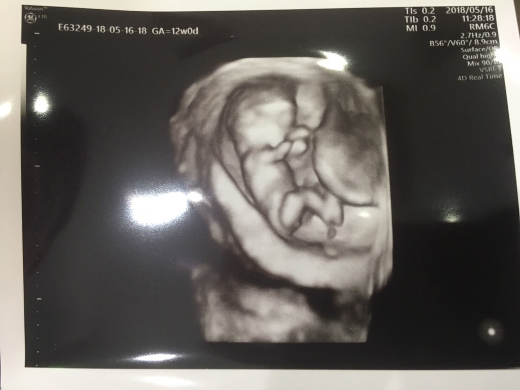 f:id:sippuu0517:20180910032552j:plain