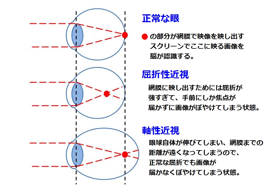 f:id:siryokukaizen:20190521053418j:plain