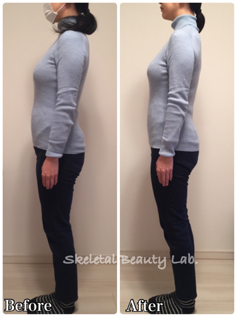f:id:skeletalbeautylab:20180513174155j:image f:id:skeletalbeautylab:20180513174155j:image