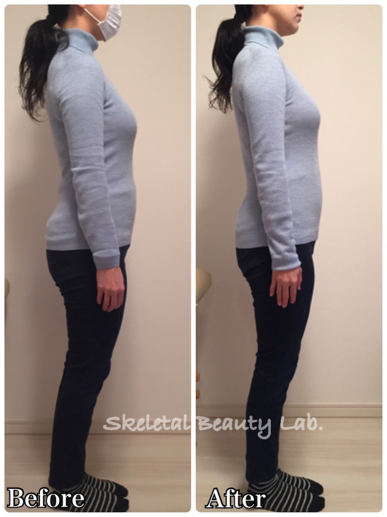 f:id:skeletalbeautylab:20180513174205j:image f:id:skeletalbeautylab:20180513174205j:image