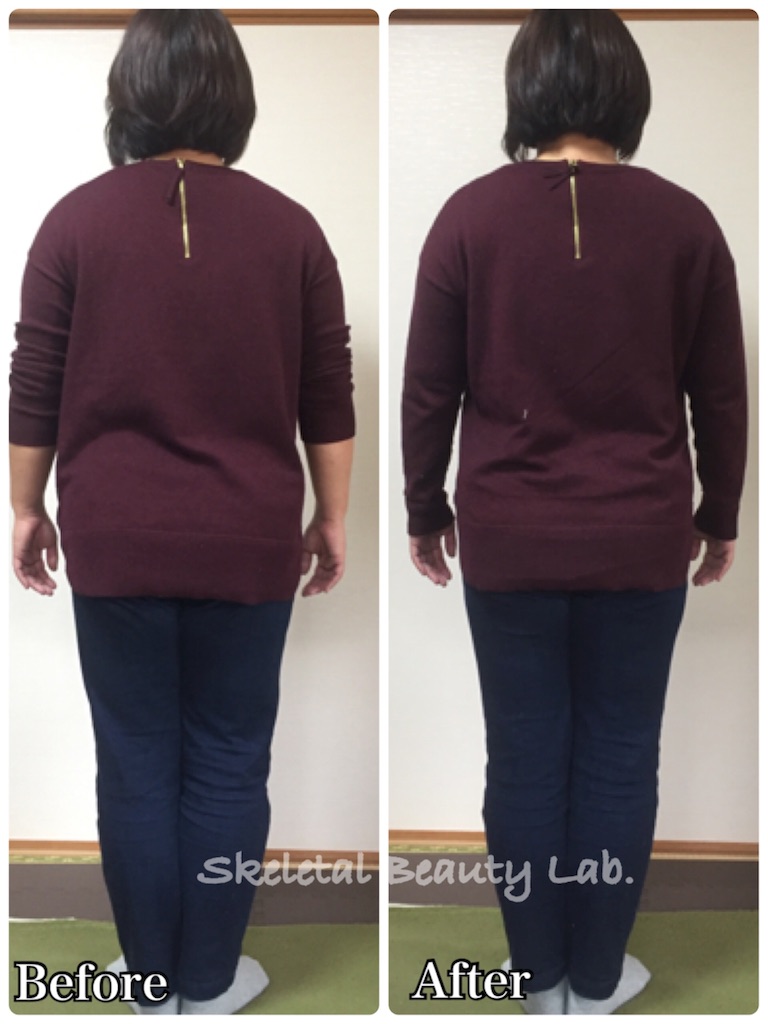 f:id:skeletalbeautylab:20180513175039j:image f:id:skeletalbeautylab:20180513175039j:image