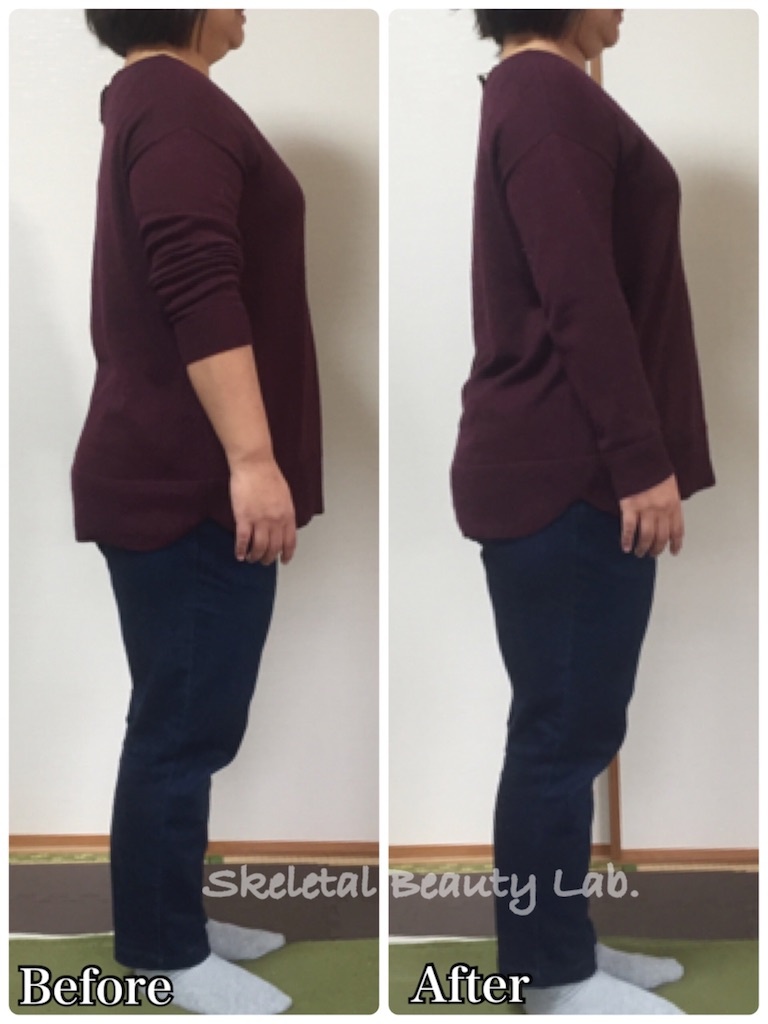 f:id:skeletalbeautylab:20180513175134j:image f:id:skeletalbeautylab:20180513175134j:image