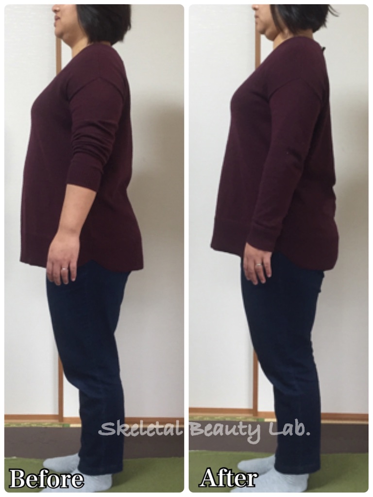 f:id:skeletalbeautylab:20180513175143j:image f:id:skeletalbeautylab:20180513175143j:image