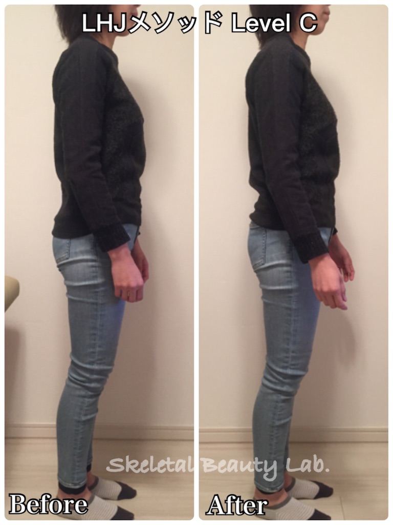 f:id:skeletalbeautylab:20180513175610j:image f:id:skeletalbeautylab:20180513175610j:image
