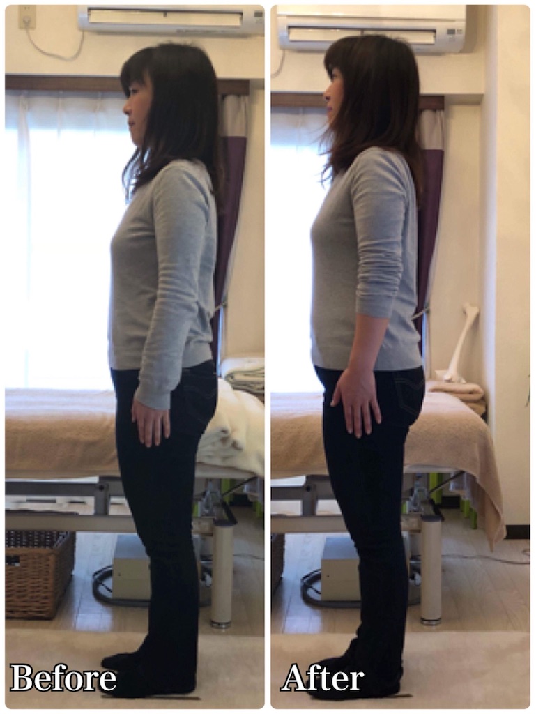 f:id:skeletalbeautylab:20180513175927j:image f:id:skeletalbeautylab:20180513175927j:image