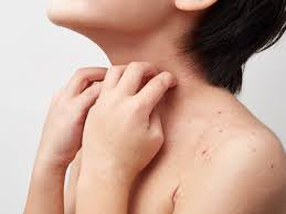 f:id:skinchange:20210303142831p:plain