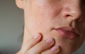 f:id:skinchange:20210313094230p:plain