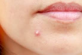 f:id:skinchange:20210313104217p:plain