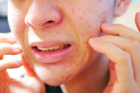 f:id:skinchange:20210313105043p:plain