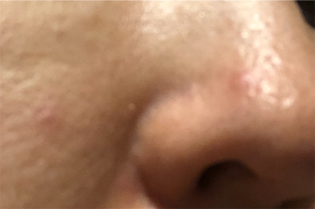 f:id:skymisha:20180830225024j:image