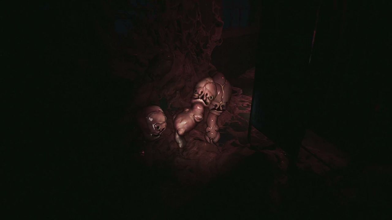 HARITI_sarcoma_2
