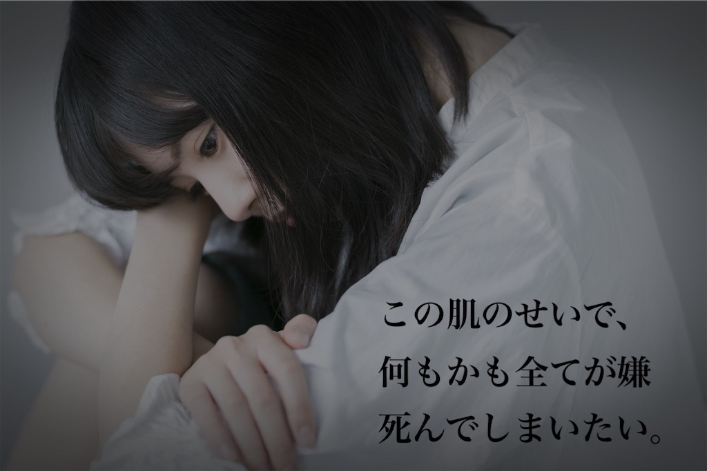 f:id:smaruchan:20201029161451j:image