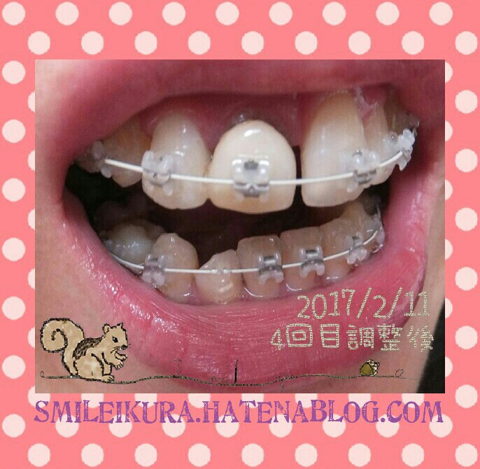 f:id:smileikura:20170211145241j:plain f:id:smileikura:20170211145241j:plain