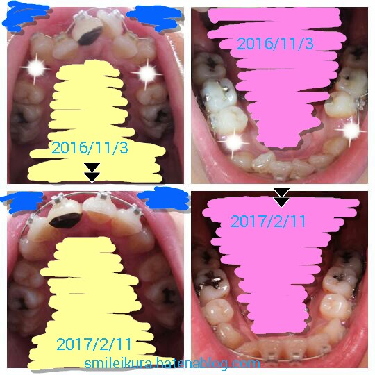 f:id:smileikura:20170211145636j:plain f:id:smileikura:20170211145636j:plain