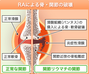 f:id:sna59717:20130518084109j:image